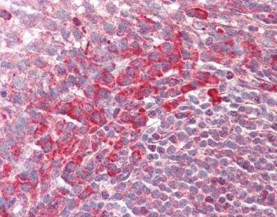 Immunohistochemistry-Paraffin: PEX13 Antibody [NBP1-31032]