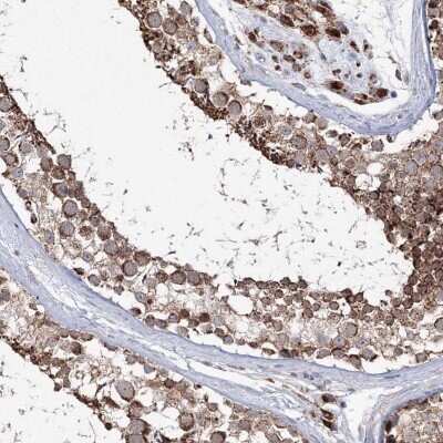 Immunohistochemistry-Paraffin: PEX13 Antibody [NBP1-86321]