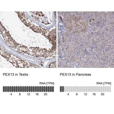 Immunohistochemistry-Paraffin: PEX13 Antibody [NBP1-86321]