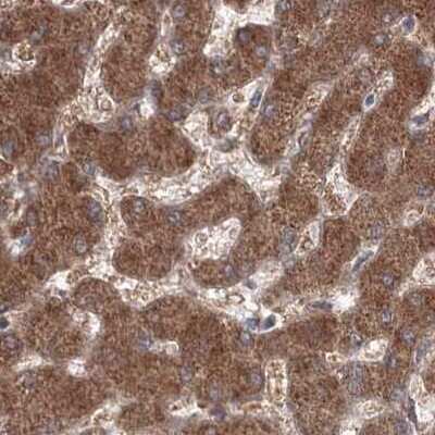 Immunohistochemistry-Paraffin: PEX13 Antibody [NBP1-86321]