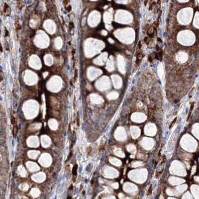 Immunohistochemistry-Paraffin: PEX13 Antibody [NBP1-86321]