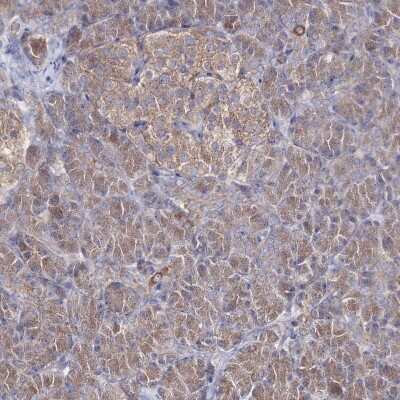 Immunohistochemistry-Paraffin: PEX13 Antibody [NBP2-38204]