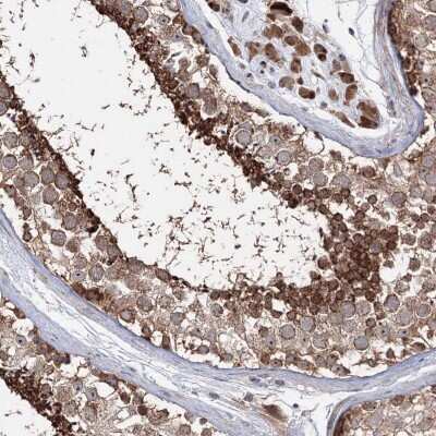 Immunohistochemistry-Paraffin: PEX13 Antibody [NBP2-38204]