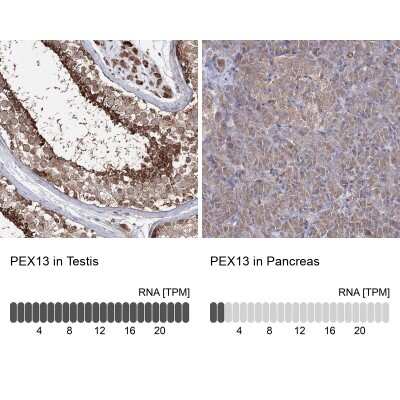 Immunohistochemistry-Paraffin: PEX13 Antibody [NBP2-38204]