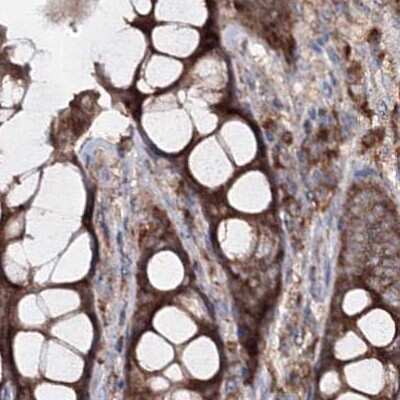 Immunohistochemistry-Paraffin: PEX13 Antibody [NBP2-38204]