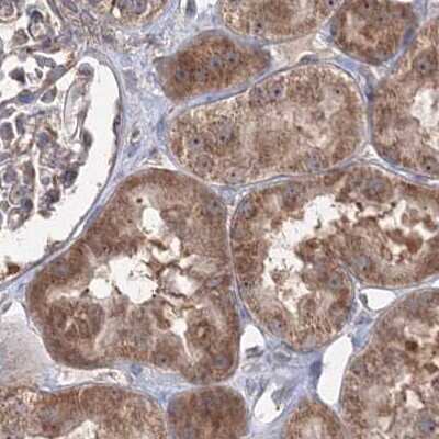 Immunohistochemistry-Paraffin: PEX13 Antibody [NBP2-38204]