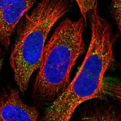 Immunocytochemistry/ Immunofluorescence: PEX14 Antibody [NBP2-33455]