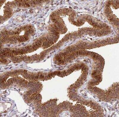 Immunohistochemistry-Paraffin: PEX14 Antibody [NBP2-33455]