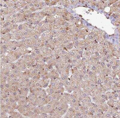 Immunohistochemistry-Paraffin: PEX14 Antibody [NBP2-33455]