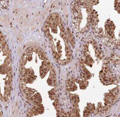 Immunohistochemistry-Paraffin: PEX14 Antibody [NBP2-33455]