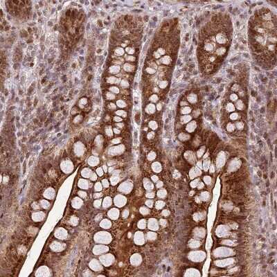 Immunohistochemistry-Paraffin: PEX14 Antibody [NBP2-33455]