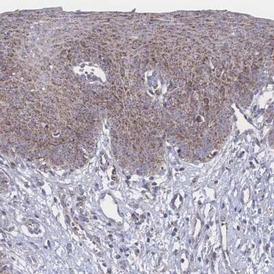 Immunohistochemistry-Paraffin: PEX14 Antibody [NBP2-33556]
