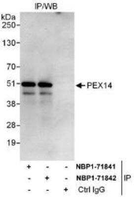 Immunoprecipitation: PEX14 Antibody [NBP1-71841]