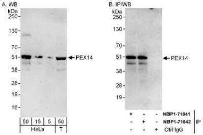 Western Blot: PEX14 Antibody [NBP1-71842]