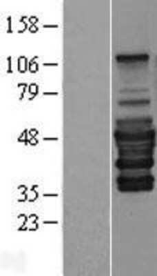 Western Blot: PEX14 Overexpression Lysate [NBP2-07857]