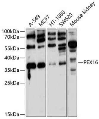 Western Blot: PEX16 AntibodyBSA Free [NBP2-93468]