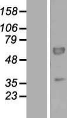 Western Blot: PEX16 Overexpression Lysate [NBL1-14299]