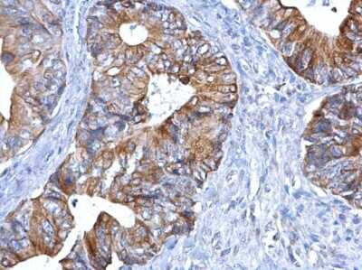Immunohistochemistry-Paraffin: PEX19 Antibody (554) [NBP2-43544]