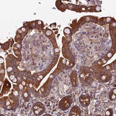 Immunohistochemistry-Paraffin: PEX19 Antibody [NBP1-92255]