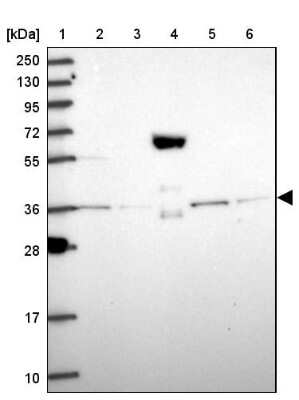 Western Blot: PEX19 Antibody [NBP1-92255]