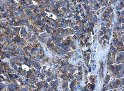 Immunohistochemistry-Paraffin: PEX26 Antibody [NBP1-32743]