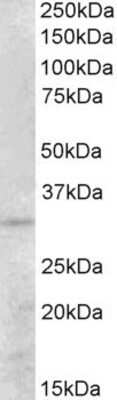 Western Blot: PEX26 Antibody [NBP1-52048]