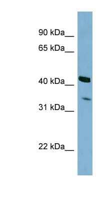 Western Blot: PEX26 Antibody [NBP1-55114]