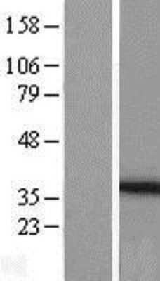 Western Blot: PEX26 Overexpression Lysate [NBP2-09456]