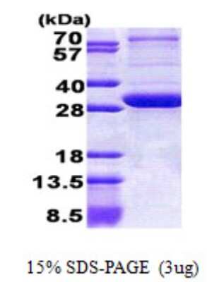 SDS-PAGE: Recombinant Human PEX26 His Protein [NBP2-23321]