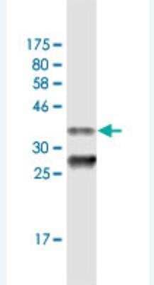 Western Blot: PEX3 Antibody (3C2) [H00008504-M04]