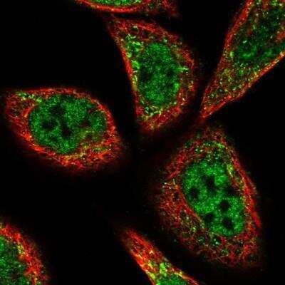 Immunocytochemistry/ Immunofluorescence: PEX3 Antibody [NBP1-86210]