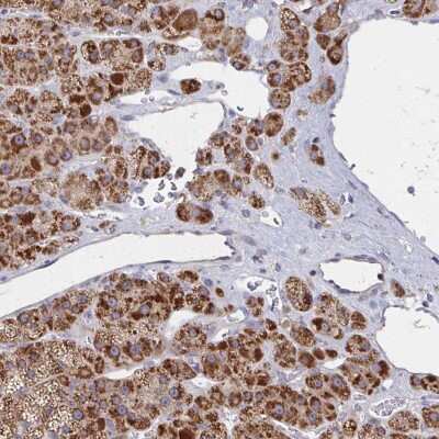 Immunohistochemistry: PEX3 Antibody [NBP2-38838]