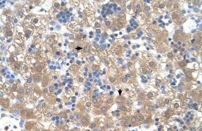 Immunohistochemistry-Paraffin: PEX3 Antibody [NBP1-52960]