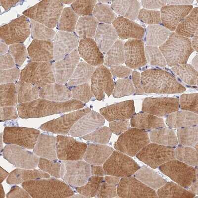 Immunohistochemistry-Paraffin: PEX3 Antibody [NBP1-86210]