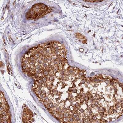 Immunohistochemistry-Paraffin: PEX3 Antibody [NBP1-86210]