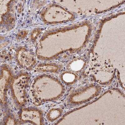 Immunohistochemistry-Paraffin: PEX3 Antibody [NBP1-86210]