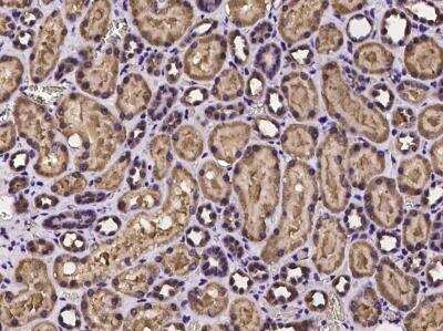 Immunohistochemistry-Paraffin: PEX3 Antibody [NBP3-06433]