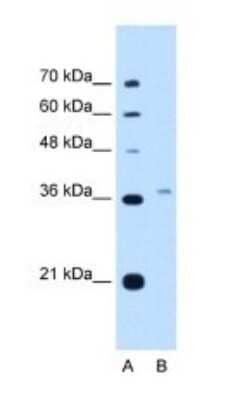 Western Blot: PEX3 Antibody [NBP1-52960]