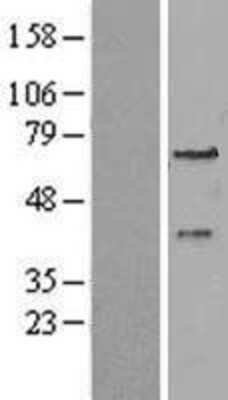 Western Blot: PEX3 Overexpression Lysate [NBL1-14303]