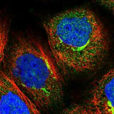 Immunocytochemistry/ Immunofluorescence: PEX5 Antibody [NBP2-38443]