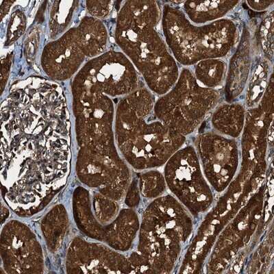 Immunohistochemistry-Paraffin: PEX5 Antibody [NBP1-87185]