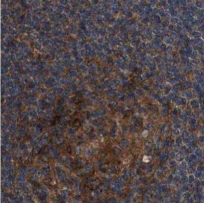 Immunohistochemistry-Paraffin: PEX5 Antibody [NBP1-87185]