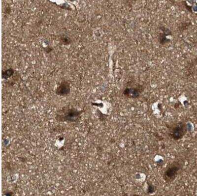 Immunohistochemistry-Paraffin: PEX5 Antibody [NBP1-87185]