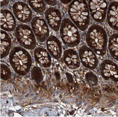 Immunohistochemistry-Paraffin: PEX5 Antibody [NBP1-87185]