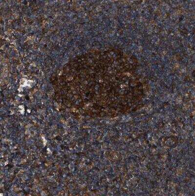 Immunohistochemistry-Paraffin: PEX5 Antibody [NBP1-87185]