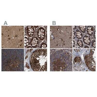 Immunohistochemistry-Paraffin: PEX5 Antibody [NBP1-87185]