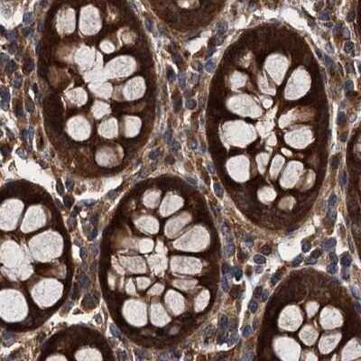 Immunohistochemistry-Paraffin: PEX5 Antibody [NBP1-87185]