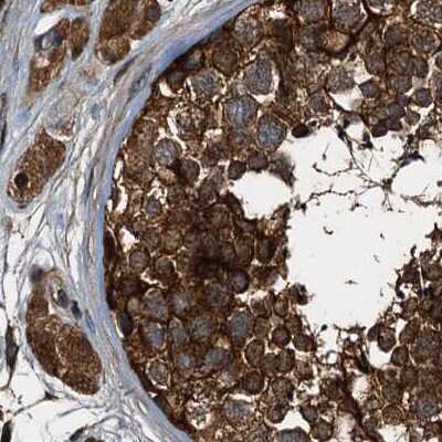 Immunohistochemistry-Paraffin: PEX5 Antibody [NBP1-87185]