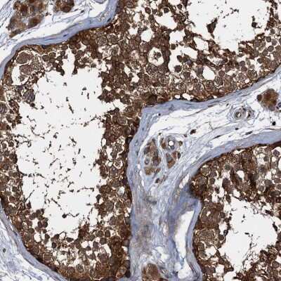 Immunohistochemistry-Paraffin: PEX5 Antibody [NBP2-38443]