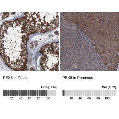 Immunohistochemistry-Paraffin: PEX5 Antibody [NBP2-38443]